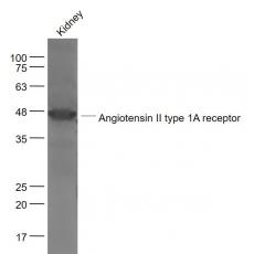 Anti-Angiotensin II type 1A receptor antibody