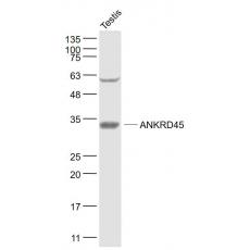 Anti-ANKRD45 antibody