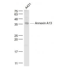 Anti-Annexin A13 antibody