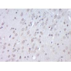 Anti-APBB3 antibody