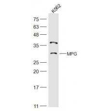 Anti-APNG/MPG antibody