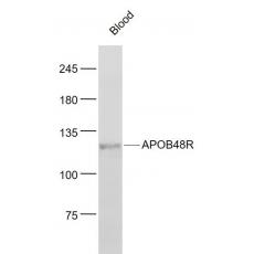 Anti-APOB48R antibody