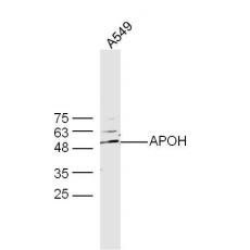 Anti-APOH antibody