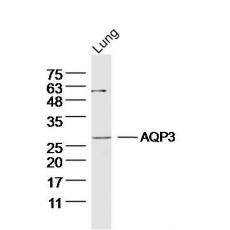 Anti-AQP3 antibody