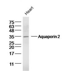 Anti-Aquaporin 2 antibody