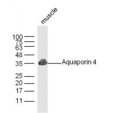 Anti-Aquaporin 4 antibody