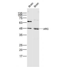 Anti-ARC antibody