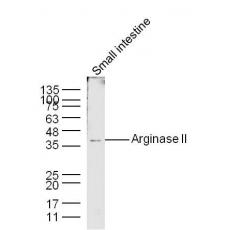 Anti-Arginase II antibody