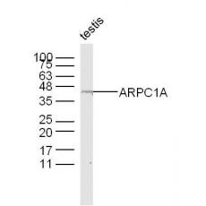 Anti-ARPC1A antibody