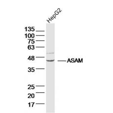 Anti-ASAM antibody
