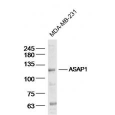 Anti-ASAP1 antibody