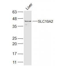 Anti-ASBT/SLC10A2 antibody