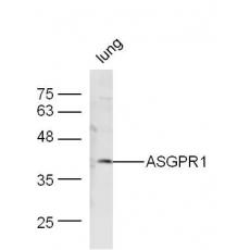 Anti-ASGPR1 antibody