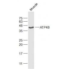 Anti-ATP4B antibody