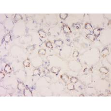 Anti-ATPase Na+/ K+ beta 2 antibody