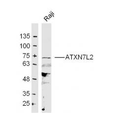 Anti-ATXN7L2 antibody