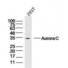 Anti-Aurora C antibody