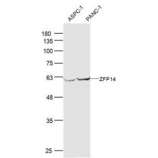 Anti-ZFP14 antibody