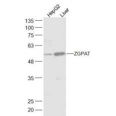 Anti-ZGPAT antibody