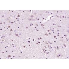 Anti-Zic2 antibody