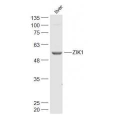Anti-ZIK1 antibody