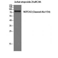 Anti-Cleaved-Notch 2 (A1734) antibody