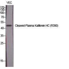 Anti-Cleaved-Plasma Kallikrein HC (R390) antibody