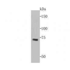 Anti-Hemagglutinin-neuraminidase antibody