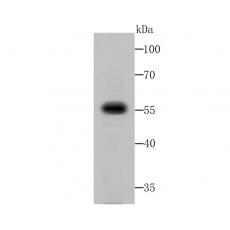 Anti-Fusion glycoprotein F0 antibody