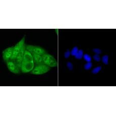 Anti-Progesterone Receptor antibody