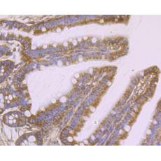 Anti-APC antibody