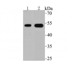 Anti-Vitamin D Receptor antibody