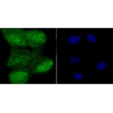 Anti-HIF1 alpha antibody