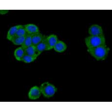 Anti-Cytokeratin 8 antibody