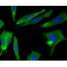 Anti-CRMP2 antibody