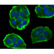 Anti-CD55 antibody