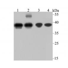 Anti-APE1 antibody