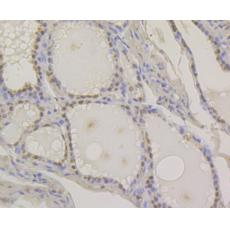 Anti-Pax8 antibody