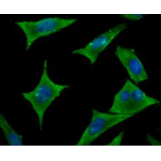 Anti-Hip1 antibody