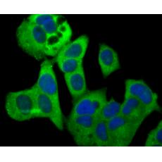 Anti-RAB7 antibody