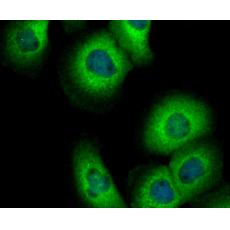 Anti-DIAPH3 antibody