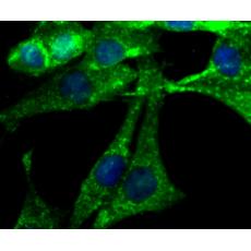 Anti-NGF antibody