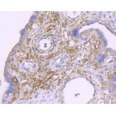 Anti-CXCL12 antibody