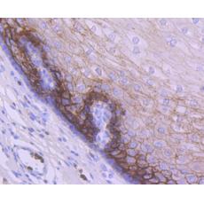 Anti-TROP2 antibody