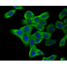 Anti-GST3 antibody
