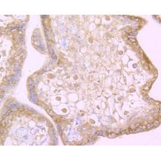 Anti-TWEAKR antibody