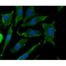 Anti-CD36 antibody