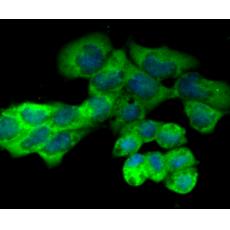 Anti-PKM2 antibody