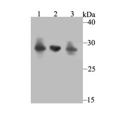 Anti-Carbonic anhydrase 2 antibody