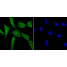 Anti-BubR1 antibody